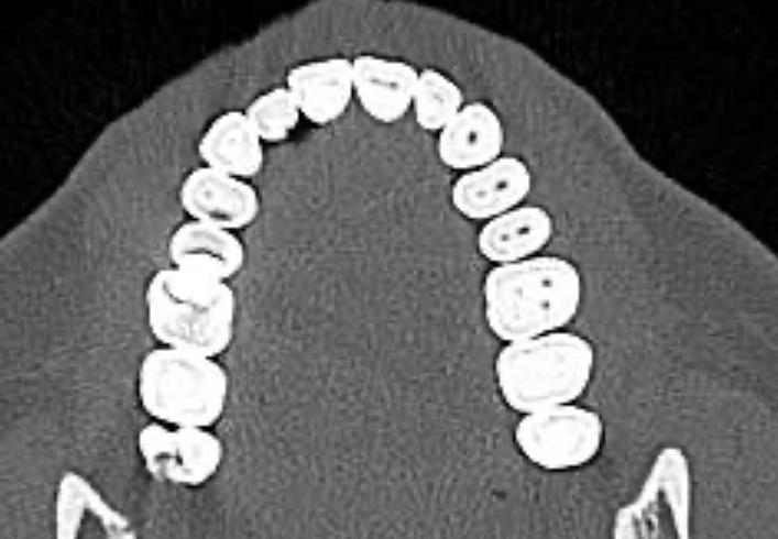 teeth